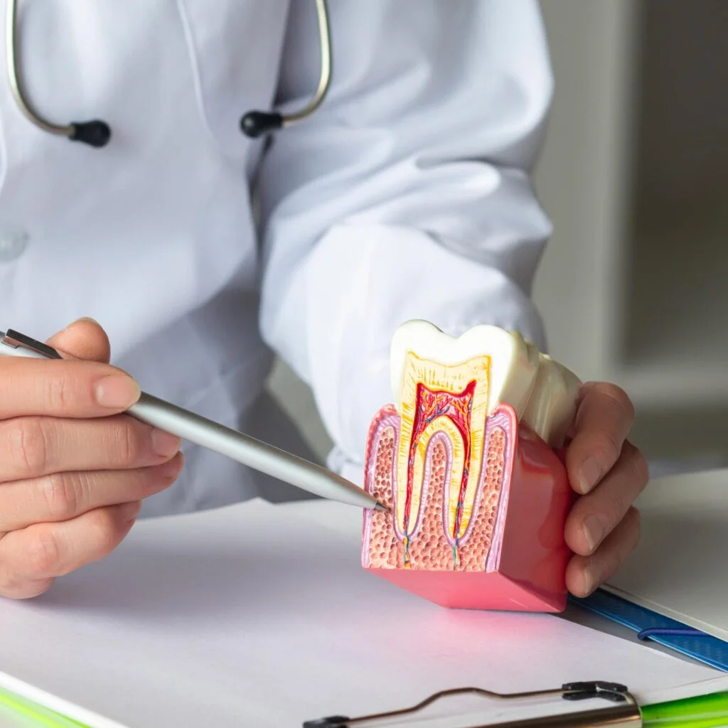 Devitalizzazione dente a Badia Polesine e Rovigo